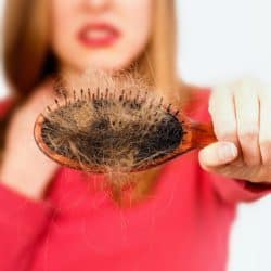 Woman holding hair brush full of hair that fell out