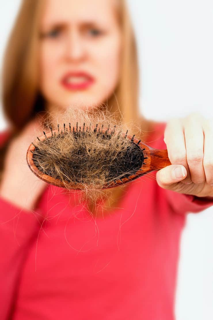 Woman holding hair brush full of hair that fell out