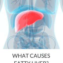 Collage with X-Ray image of liver and title text overlay: What Causes Fatty Liver?