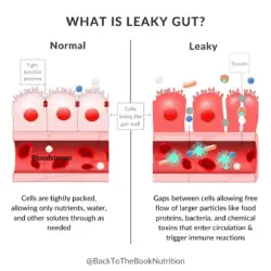 Graphic comparing a Leaky Gut to normal gut