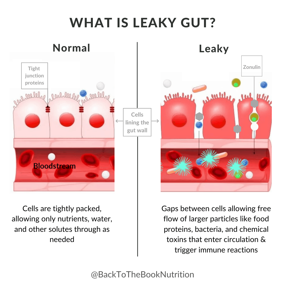 Graphic comparing a Leaky Gut to normal gut 