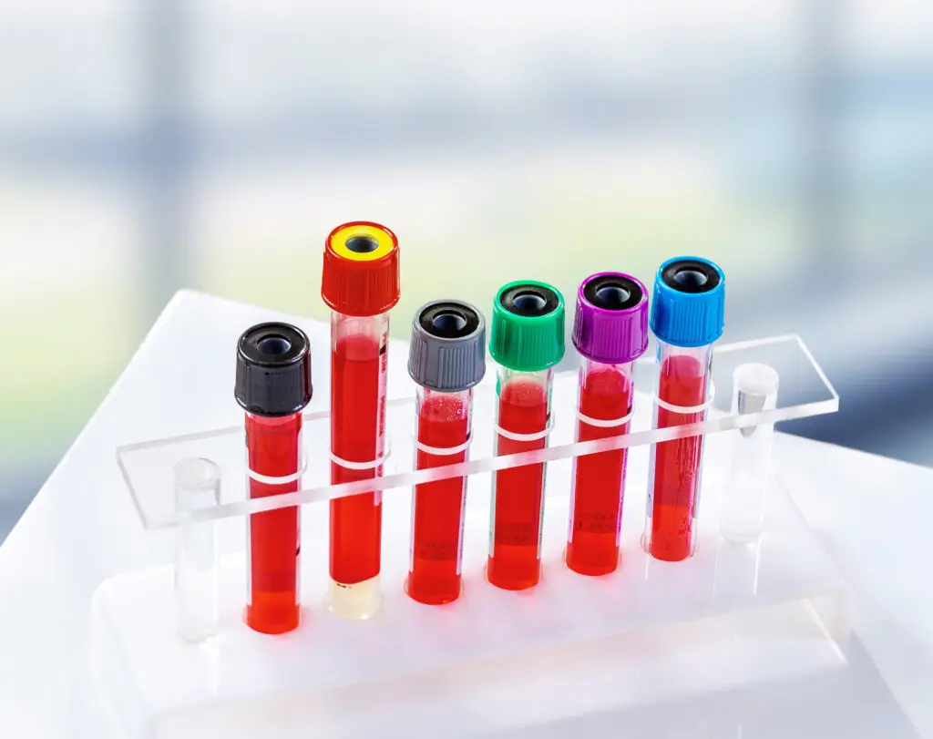 Vials in container at lab